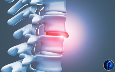 Ernia del disco: che aiuto può darci la Posturologia?
